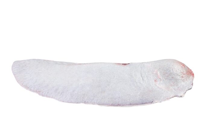 Baço / Spleen - Image 1